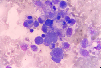 mesothelial cell