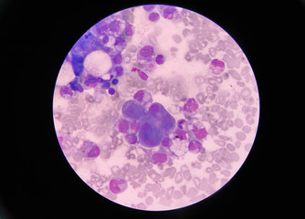 mesothelial cell