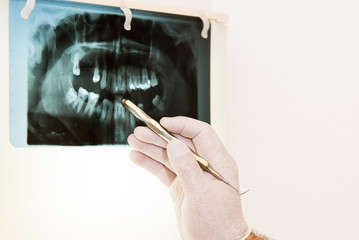 zahnarzt erklärt ein röntgenbild