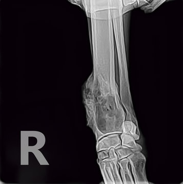 X-ray of osteosarcoma bone tumor foreleg  a dog.