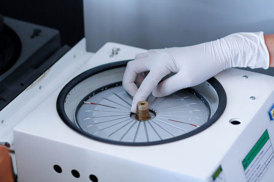 blood sample for hematocrit testing