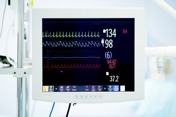 heart monitor during surgery