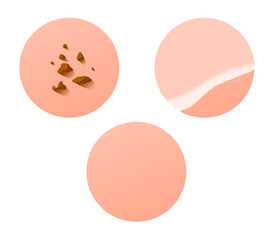 Dirty skin , Cleaning skin , Normal skin