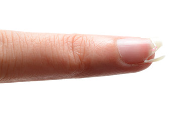 Broken Finger Nail