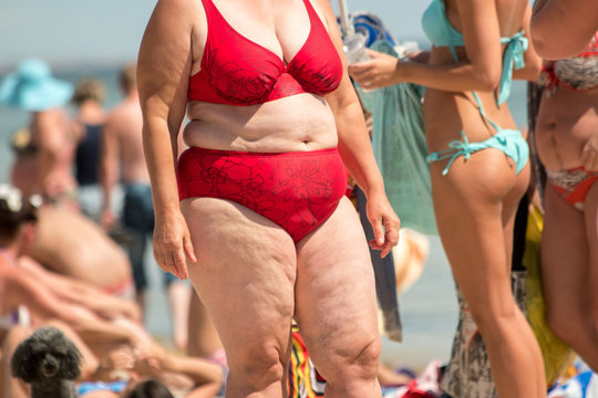 Obese woman in swimsuit. People on the beach. Sedentary lifestyle and poor  nutrition. Risk of heart illnesses. Stock Photo | Adobe Stock
