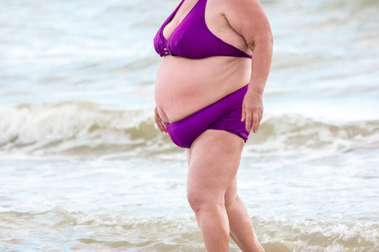 Fat lady on the beach. Obese woman wearing swimsuit. Change lifestyle to  become healthier. Increased risk of hernia development. Stock Photo | Adobe  Stock