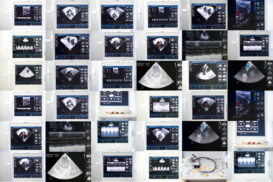 a collage of images of ultrasound machine