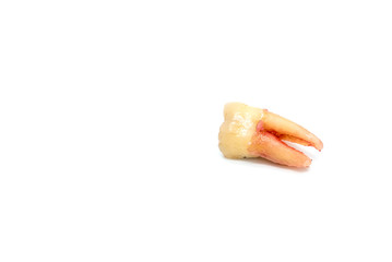 broken tooth removal with dental caries on white