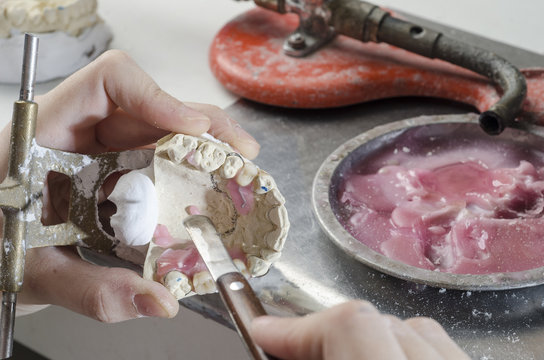 Dental technician doing partial dentures of acrylic resins.