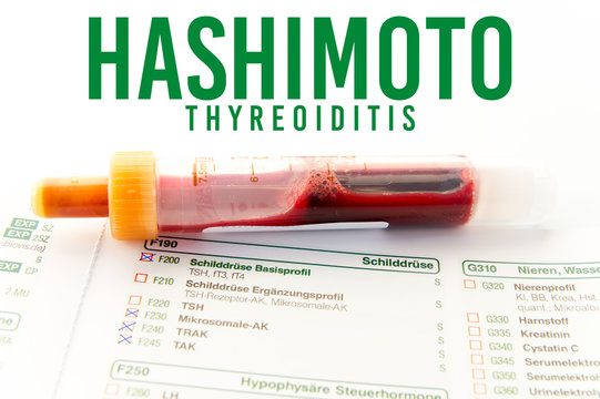 Hashimoto Thyreoiditis / Blutabnahme zum bestimmen der Schilddr&uuml;senwerte eines Hashimoto - Patienten