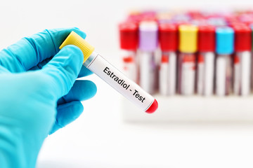 Estradiol hormone (female hormone) test