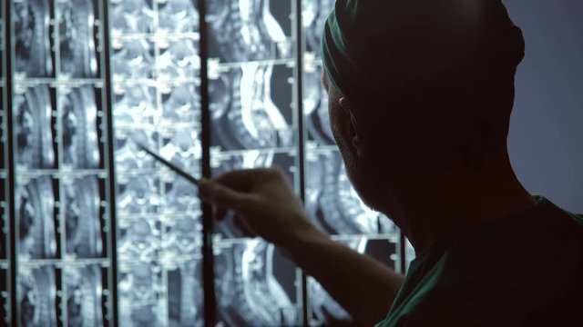 Professional doctor pointing at MRI image, rubbing chin, thinking over diagnosis