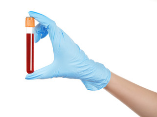 Hand holding test tube with blood isolated on white