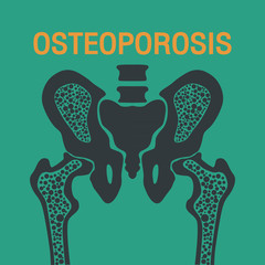 OSTEOPOROSIS vector logo icon design