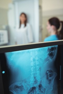 Close-up of x-ray monitor