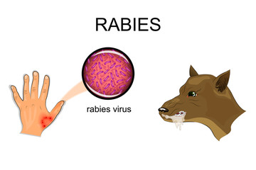 dog bite, sick animal, the rabies virus