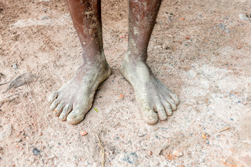 Legs of a labor with muddy