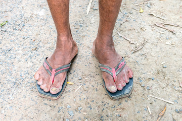 Legs of a labor with muddy