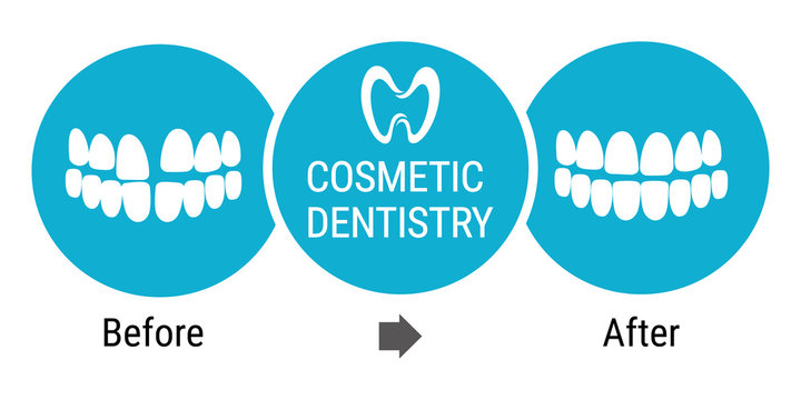 Cosmetic Dentistry. Medical Infografics: Dental Services. Cosmetic Dentist Before And After. Dental Design Over White Background Vector Illustration