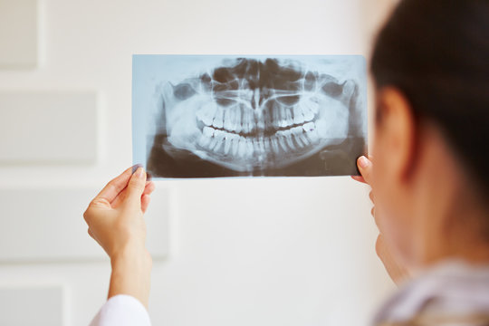 Frau als Radiologin mit Röntgenbild