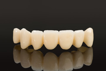 Crown seven elements on zirconium oxide, detail of the layering ceramic dental implant.