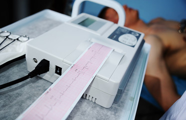 Electrocardiogram, ECG in hand. Clinic of Cardiology heart rate and pulse test closeup. Cardiogram...