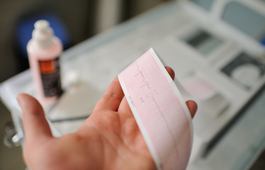 Printing of cardiogram report coming out from Electrocardiograph in labour ward