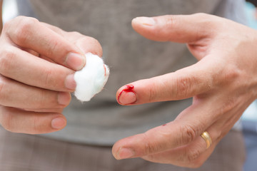 The index finger of the accident from the work. Use a cotton ball plating alcohol, paint around the wound disinfection.