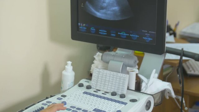 Ultrasound modern equipment. Female unrecognizable doctor operating U S test unit. 4K.