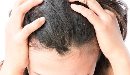 Fototapeta premium Kobieta poważny problem utraty włosów dla szamponu i beau opieki zdrowotnej