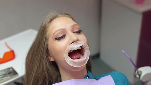 Close-up of a girl with a expander mouth at the dental clinic.  A young girl in a modern dental office.