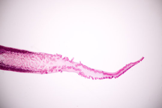 Flukes infestation (parasite) under microscope view.