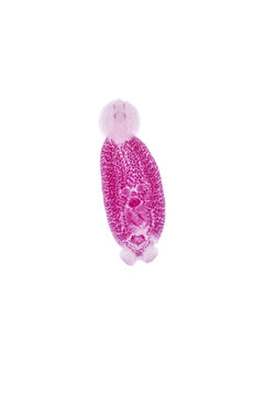 Flukes infestation (parasite) under microscope view.