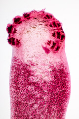 Flukes infestation (parasite) under microscope view.