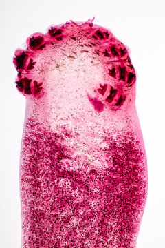 Flukes infestation (parasite) under microscope view.