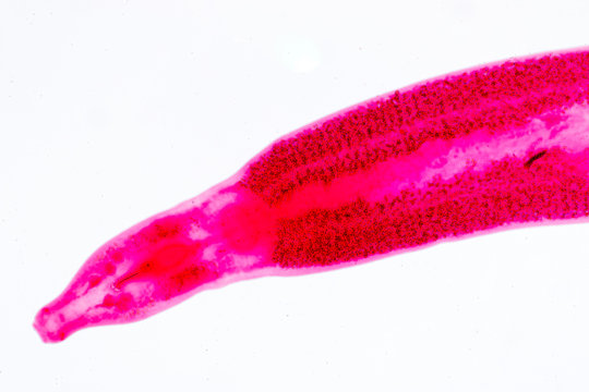 Flukes infestation (parasite) under microscope view.