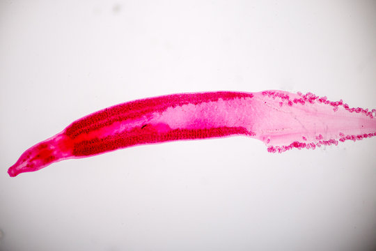 Flukes infestation (parasite) under microscope view.