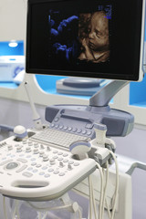 Apparatus for ultrasonic diagnosis