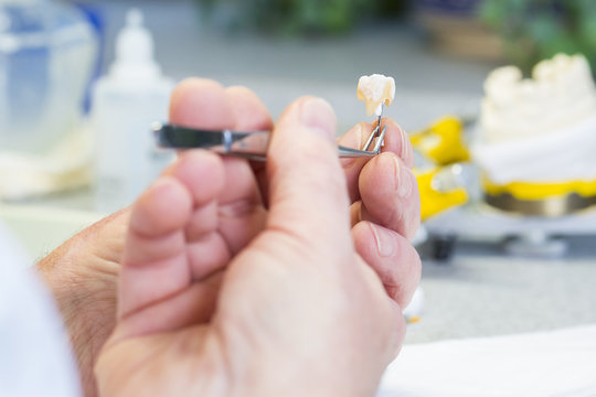 Dentaltechniker bearbeitet Krone