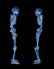 Obraz na płótnie Canvas The pattern human skeletons X-Ray on black background ,skeleton pattern puppet, skull model Ghost