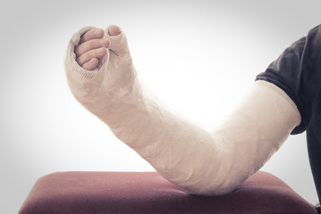 Long arm plaster / fiberglass cast resting on ottoman