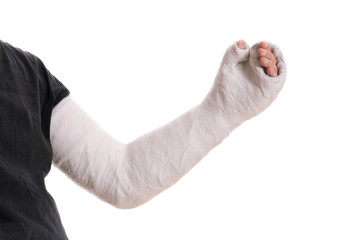 Young man wearing a long arm plaster / fiberglass cast