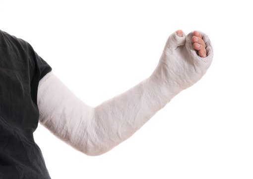 Arm Cast Images – Browse 20,886 Stock Photos, Vectors, and Video