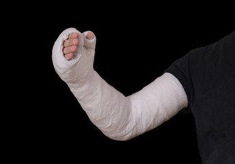 Young man wearing a long arm plaster / fiberglass cast