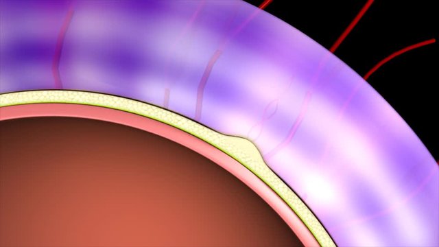 Cytotrophoblastic shell
