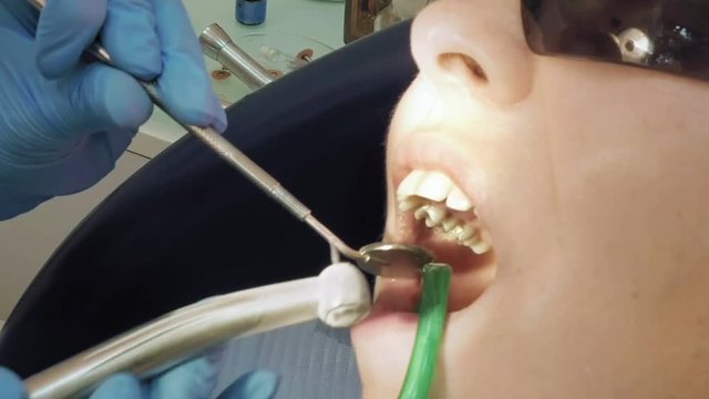 Woman at the dentist clinic office gets dental medical examination and treatment. Close up shot. Odontic and mouth health is important part of modern human life that dentistry help with.