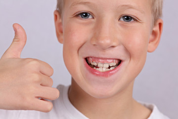 Removable Braces for childen. Happy smiling boy with orthodontic appliance showing thumbs up