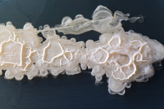 Bacteria growing on a perti dish.
