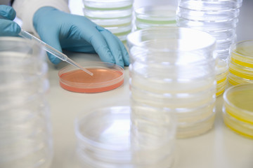 Closeup of scientist adding drops to petri dish in laboratory