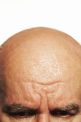 Extreme closeup of a middle aged man's bald head and eyes against white background